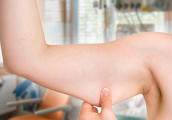 Hover image for Those managing or preventing sarcopenia and age-related muscle loss